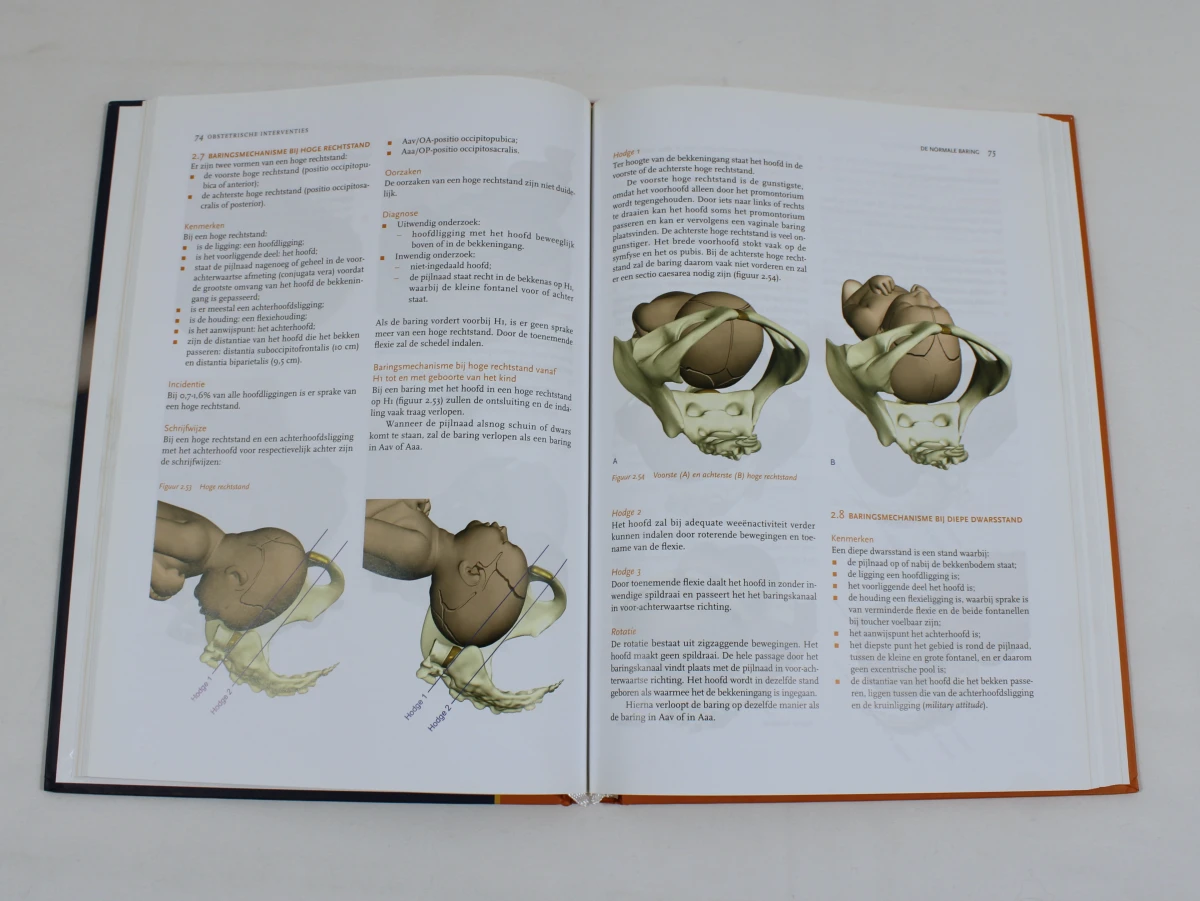 Obstetrische Interventies [Hardcover]