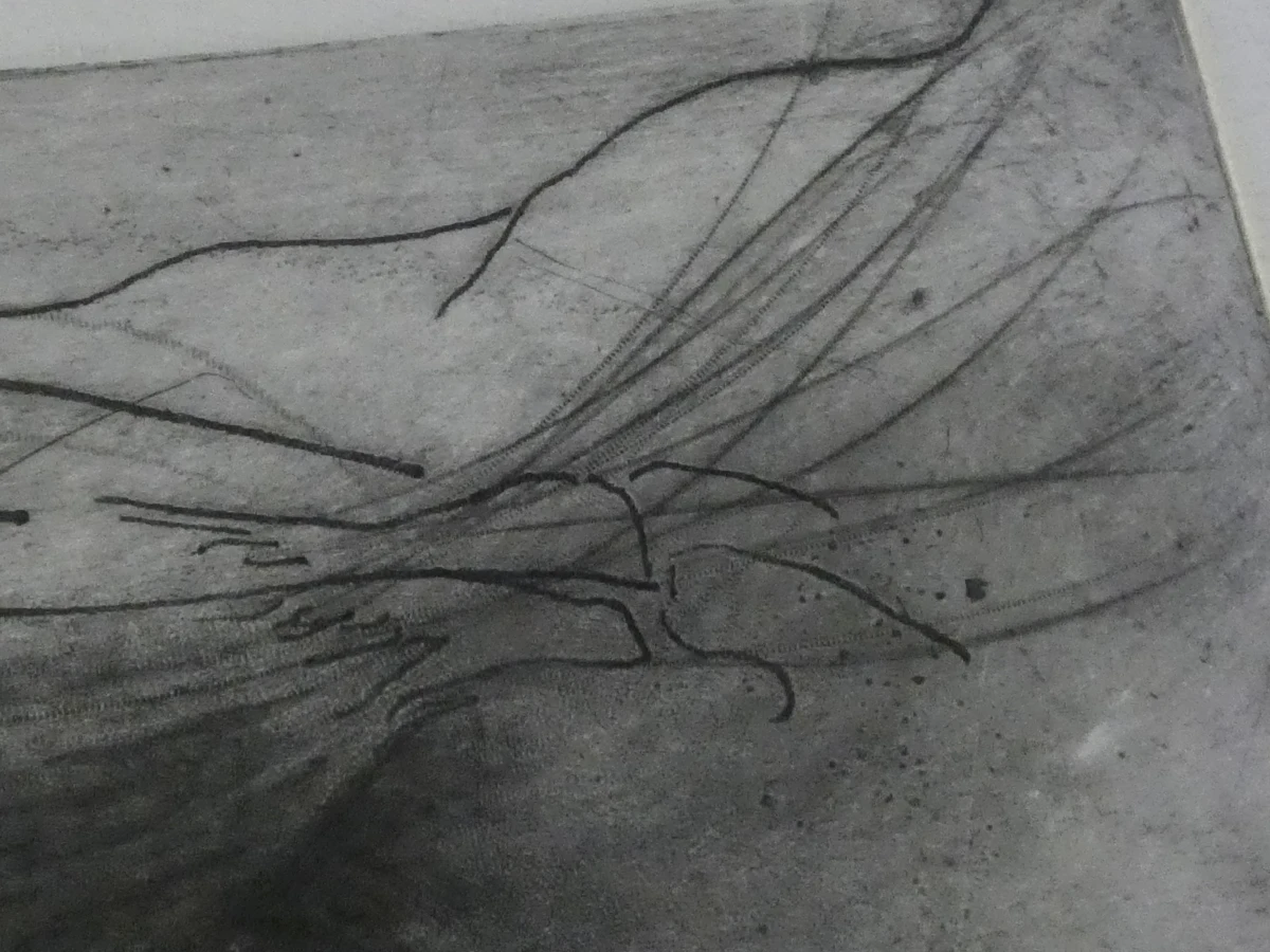 Ets anatomiestudie arm en spieren